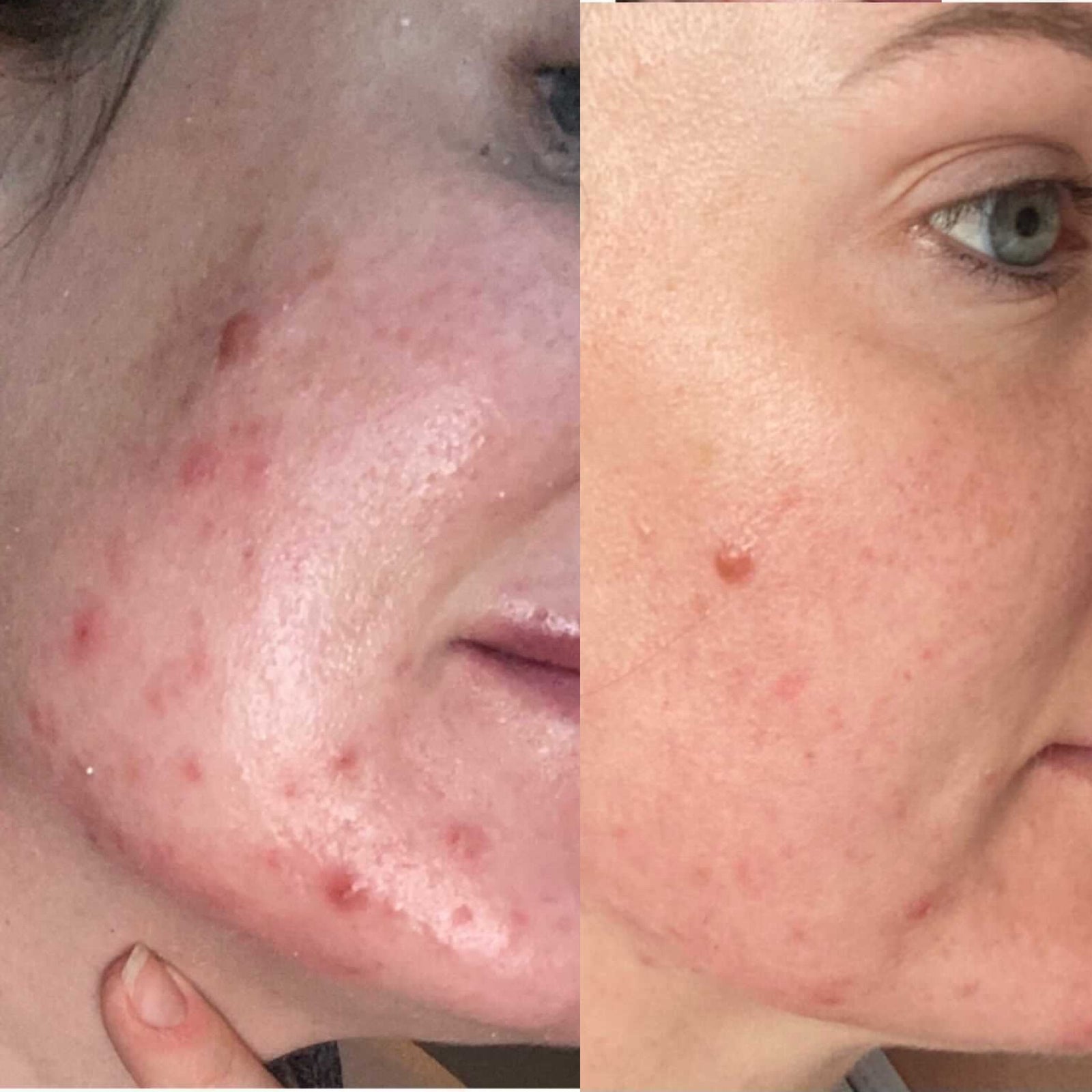 KLARSKIN REVIEW: CAROLINE MCLEAN