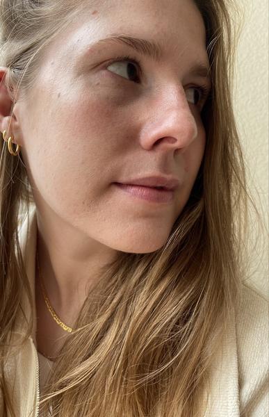 KLARSKIN REVIEW: VALERIA BRÖHL